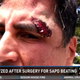 The gash above Roger Carlos’ eye is one of the injuries he sustained after being beaten by San Antonio cops.
KENS 5 screenshot
